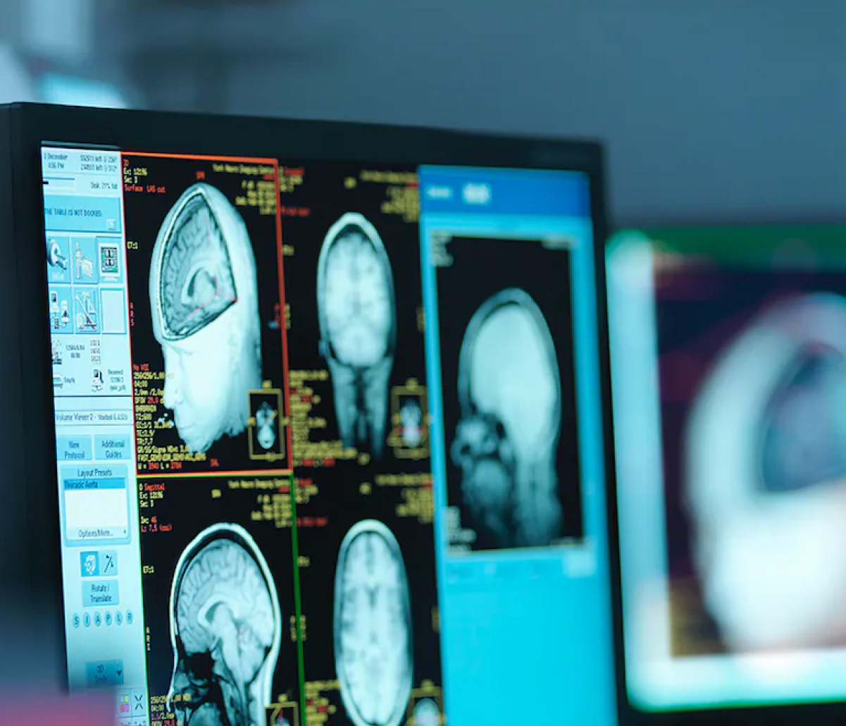 Explorar una respuesta fundamental a un ataque de malware